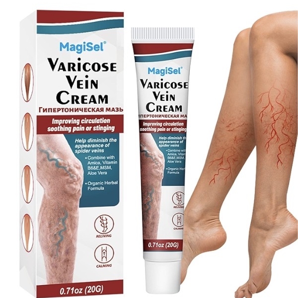Varices Crème, Crème pour Les Varices, Varices Jambes Crème, Crème Contre Les Varicosités, Araignée Veine Varices Veines Crème Pour Jambe, Crème de Soin Hydratante Jambes, Sans douleur et rapide, 20g